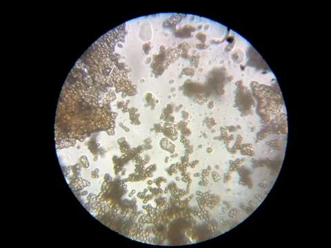 Peanuts under the microscope under the increase of spoiled mycotoxins fungi mold Stock Photos