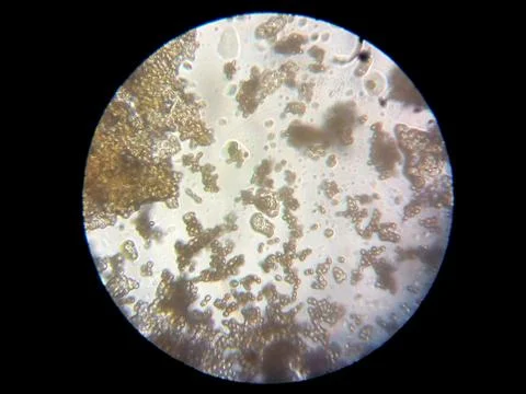 Peanuts under the microscope under the increase of spoiled mycotoxins fungi mold Stock Photos