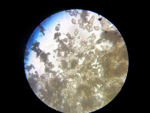 Peanuts under the microscope under the increase of spoiled mycotoxins fungi mold Stock Photos