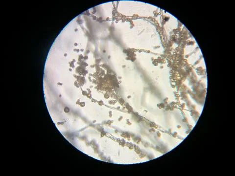 Peanuts under the microscope under the increase of spoiled mycotoxins fungi mold Stock Photos