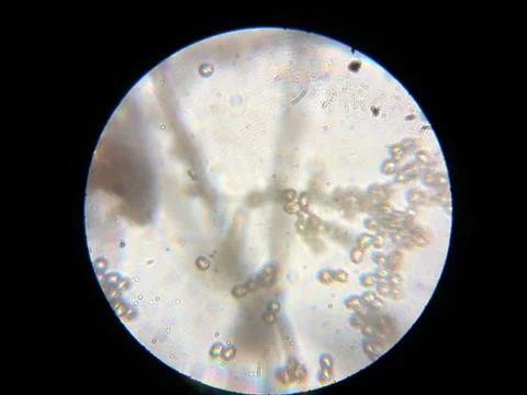 Peanuts under the microscope under the increase of spoiled mycotoxins fungi mold Stock Photos