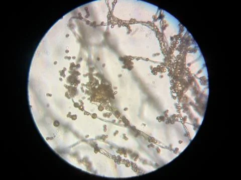 Peanuts under the microscope under the increase of spoiled mycotoxins fungi mold Stock Photos