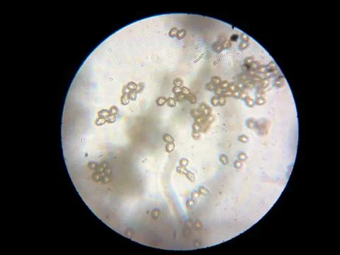 Peanuts under the microscope under the increase of spoiled mycotoxins fungi mold Stock-Fotos