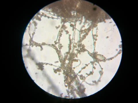 Peanuts under the microscope under the increase of spoiled mycotoxins fungi mold Stock Photos