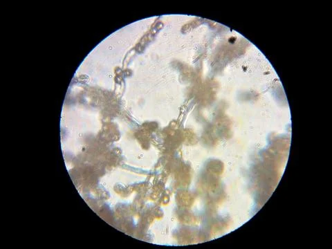 Peanuts under the microscope under the increase of spoiled mycotoxins fungi mold Stock Photos