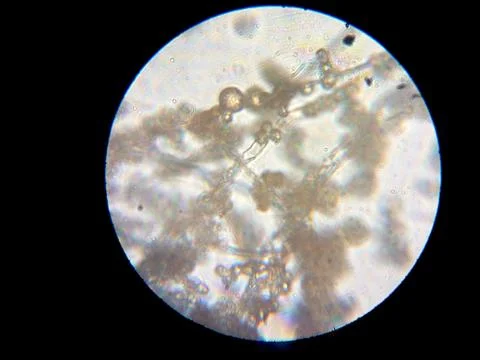 Peanuts under the microscope under the increase of spoiled mycotoxins fungi mold Stock Photos