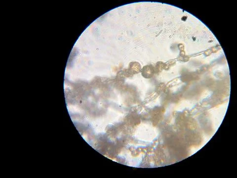 Peanuts under the microscope under the increase of spoiled mycotoxins fungi mold Stock-Fotos