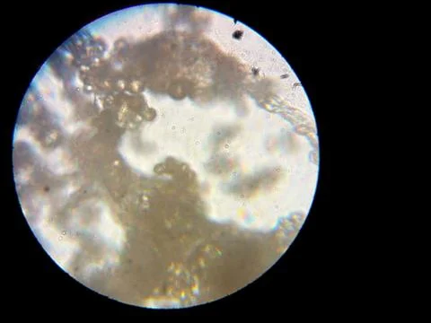 Peanuts under the microscope under the increase of spoiled mycotoxins fungi mold Stock Photos