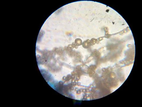 Peanuts under the microscope under the increase of spoiled mycotoxins fungi mold Stock Photos