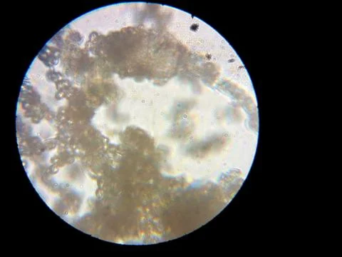 Peanuts under the microscope under the increase of spoiled mycotoxins fungi mold Stock Photos