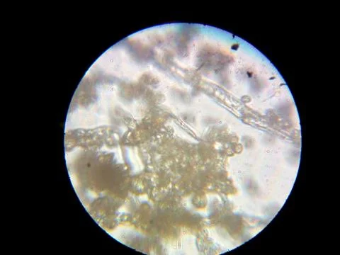 Peanuts under the microscope under the increase of spoiled mycotoxins fungi mold Stock-Fotos