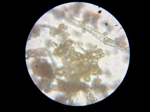 Peanuts under the microscope under the increase of spoiled mycotoxins fungi mold Stock Photos