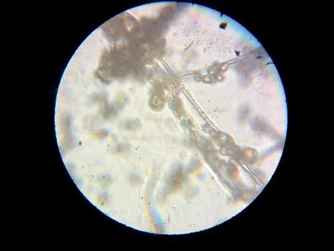 Peanuts under the microscope under the increase of spoiled mycotoxins fungi mold Foto stock