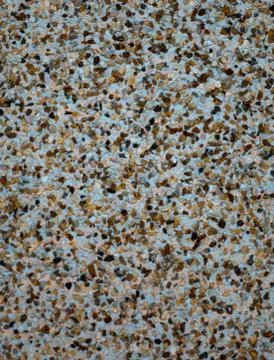 Pebbledash textured background Stock Photos
