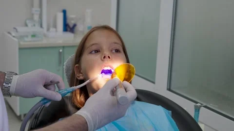 Pediatric dentist using UV curing light lamp on tooth filling for young girl. Vidéo 340630568