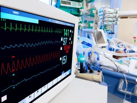 Pediatric icu with ecg monitor Stock Photos