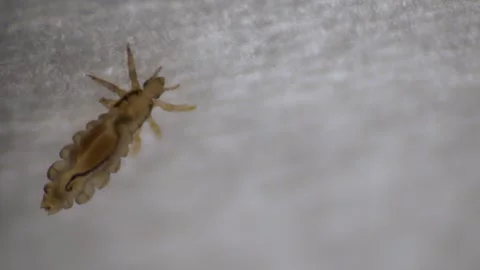 Pediculus humanus, with numerous legs on a textured background, indicating Stock Footage 287574006