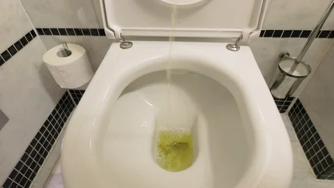 your ass hole no rule think, that you are