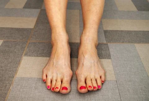 Peeling of skin Stock Photos