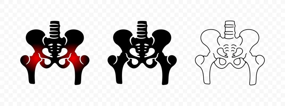 Pelvic bones or hip bone, hip inflammation in circle, orthopedic Stock Illustration