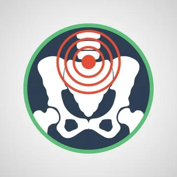 Pelvic pain vector Illustrazione stock