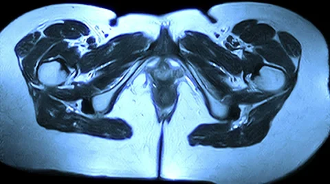 Pelvis And Hips Vidéo 34436776