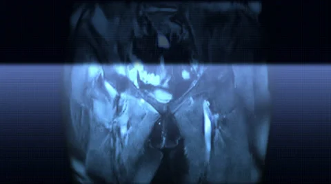 Pelvis And Hips Vidéo 34436839