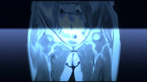 Pelvis And Hips Stock Footage 34436899