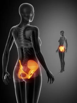 PELVIS black x--ray bone scan Stock Illustration
