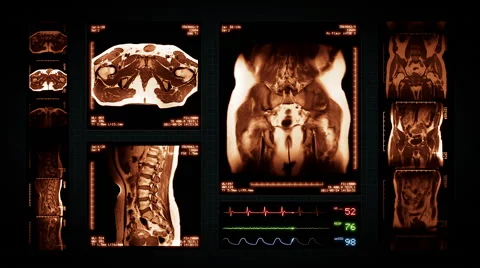 Pelvis MRI Scan. Amber. 4 in 1. Top, front, lateral view and ECG display. Stock Footage 59570970