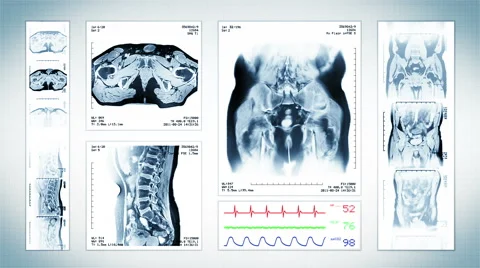 Pelvis MRI Scan. White. 4 in 1. Top, front, lateral view and ECG display. Video stock 59570968