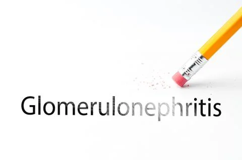 Pencil with eraser Stock Photos