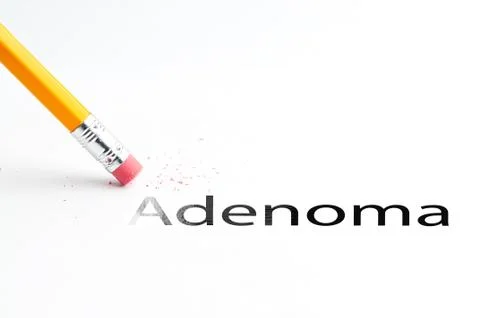 Pencil with eraser Foto stock