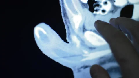 penis sexual organ mri scan. penis healt... | Stock Video | Pond5