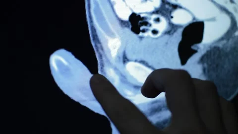 Septum of the penis – dissection, anatomical description and functional relevance