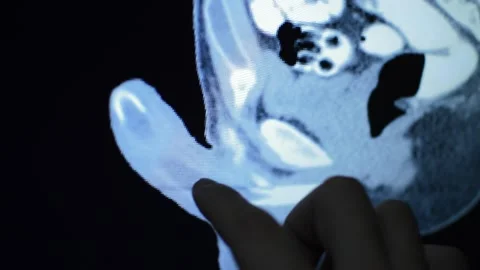 Agent Alpha Male Enhancement The Whole Truth Agent Alpha Male Enhancement Reviews Agent Alpha