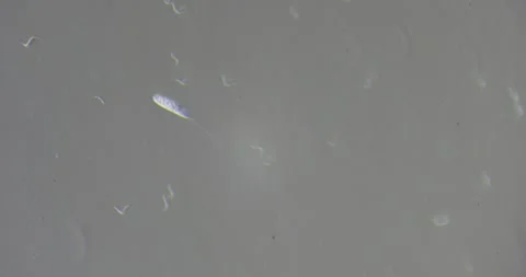 Peranema propels through microaquatic medium under 400x lens surrounded by Stock Footage 311583876