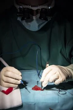 Performance of single-stremity microsurgery by a female traumatologist-surgeon. Stock Photos