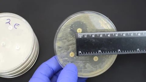 Performing antimicrobial resistance test interpretation by measuring with ruler Stock Footage 159297389