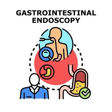 Performing gastrointestinal endoscopy test concept illustration 库存插图
