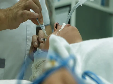 Performing surgery in operation room Video stock 81378348