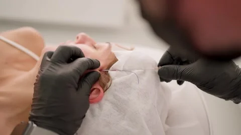 Performing thread face lifting in medical center. Cosmetologist performs thread Stock Footage 270432584