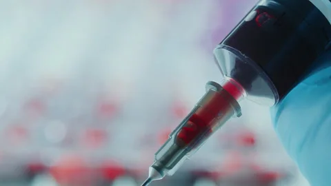 Performing Venipuncture with Syringe for Blood Testing in Laboratory Stock Footage 280198293