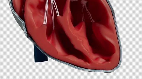 Pericarditis 動画素材 263879509