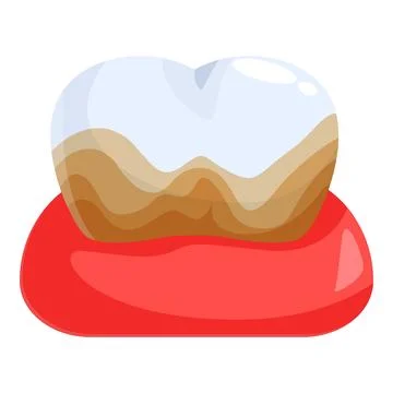 Periodontitis causing receding gums and teeth loss Stock Illustration