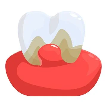 Periodontitis causing swollen gums and bleeding, damaging a tooth with caries Stock Illustration