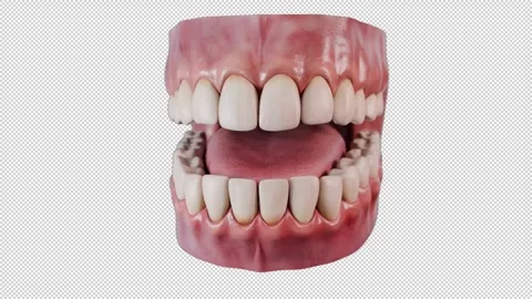 Periodontitis 스톡 동영상 316621566