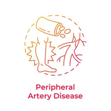 Peripheral artery disease gradient outline concept icon Stock Illustration