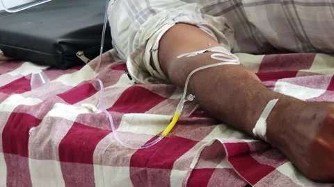 A peripheral IV catheter is secured with tape in a patient's arm. Clear tubing d Stock Footage 342477426