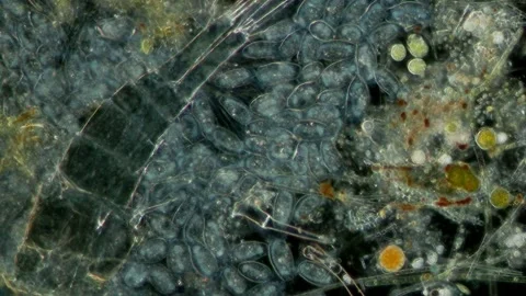 Peritrich Ciliate at 10x Under Darkfield Microscopy Stock Footage 335474537